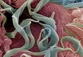 Objawy i leczenie pasożytów w ludzkim ciele