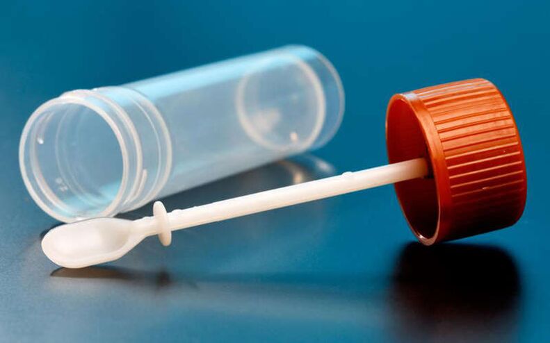 badanie kału na robaki